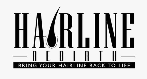 Hairline Rebirth